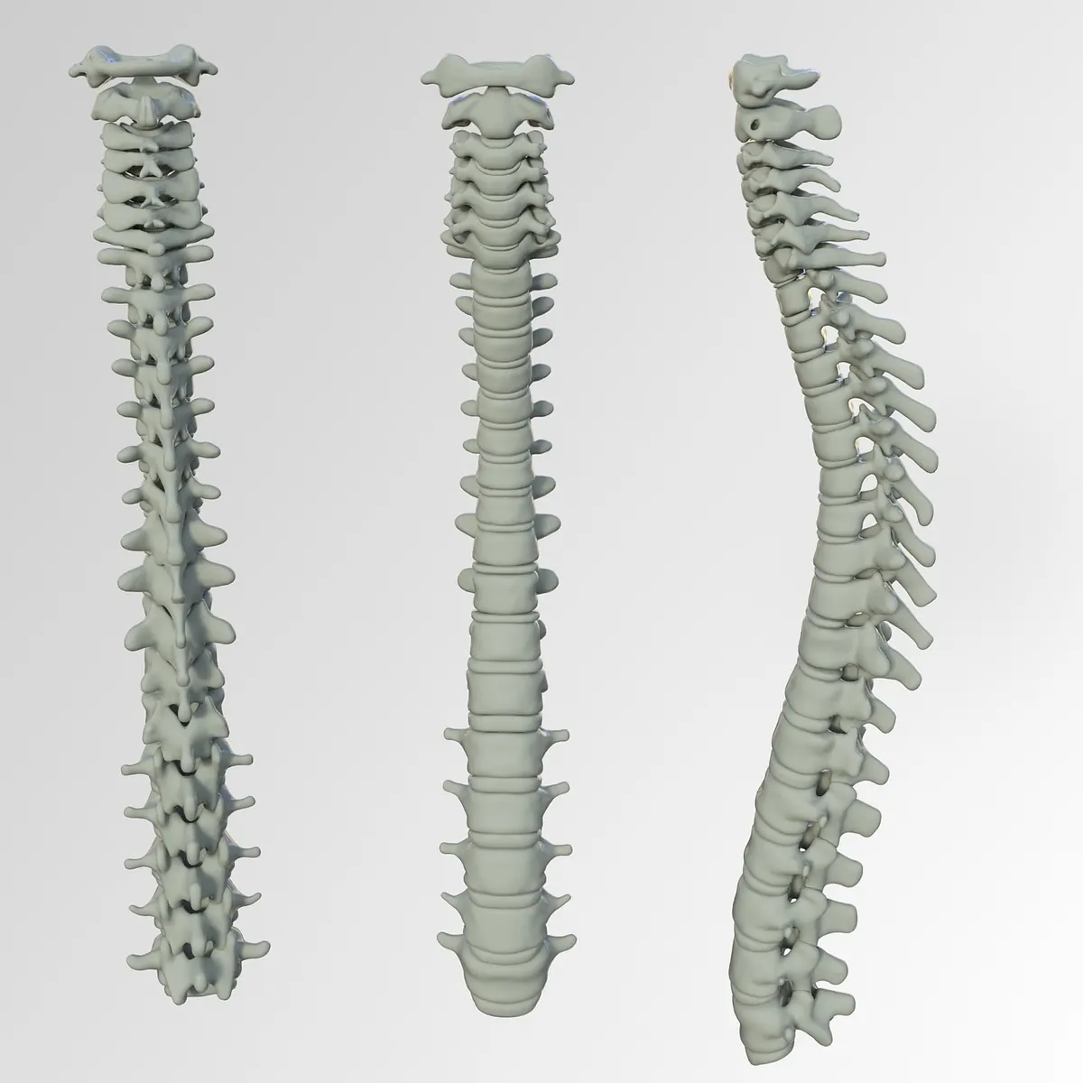 Spinal Stenosis Explained: Symptoms, Causes and Treatment Options
